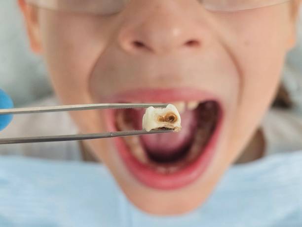 Best Orthodontic Emergency Dentist in Midway North, TX